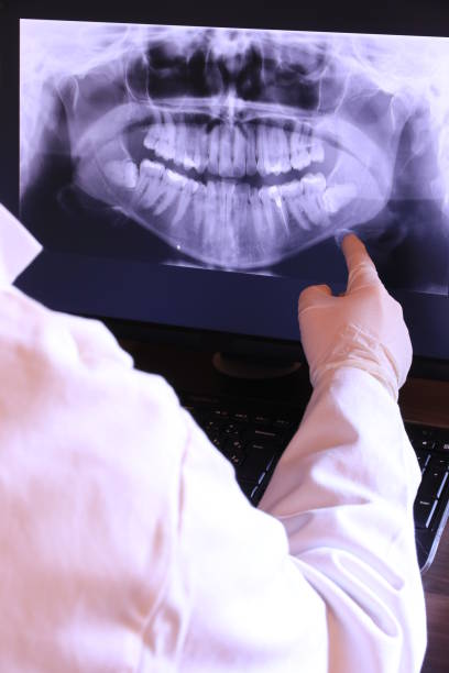 Best Emergency Wisdom Tooth Extraction in Drexel, NC