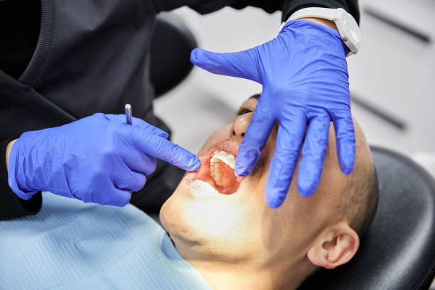 Best Emergency Care for Gum Disease in Drexel, NC